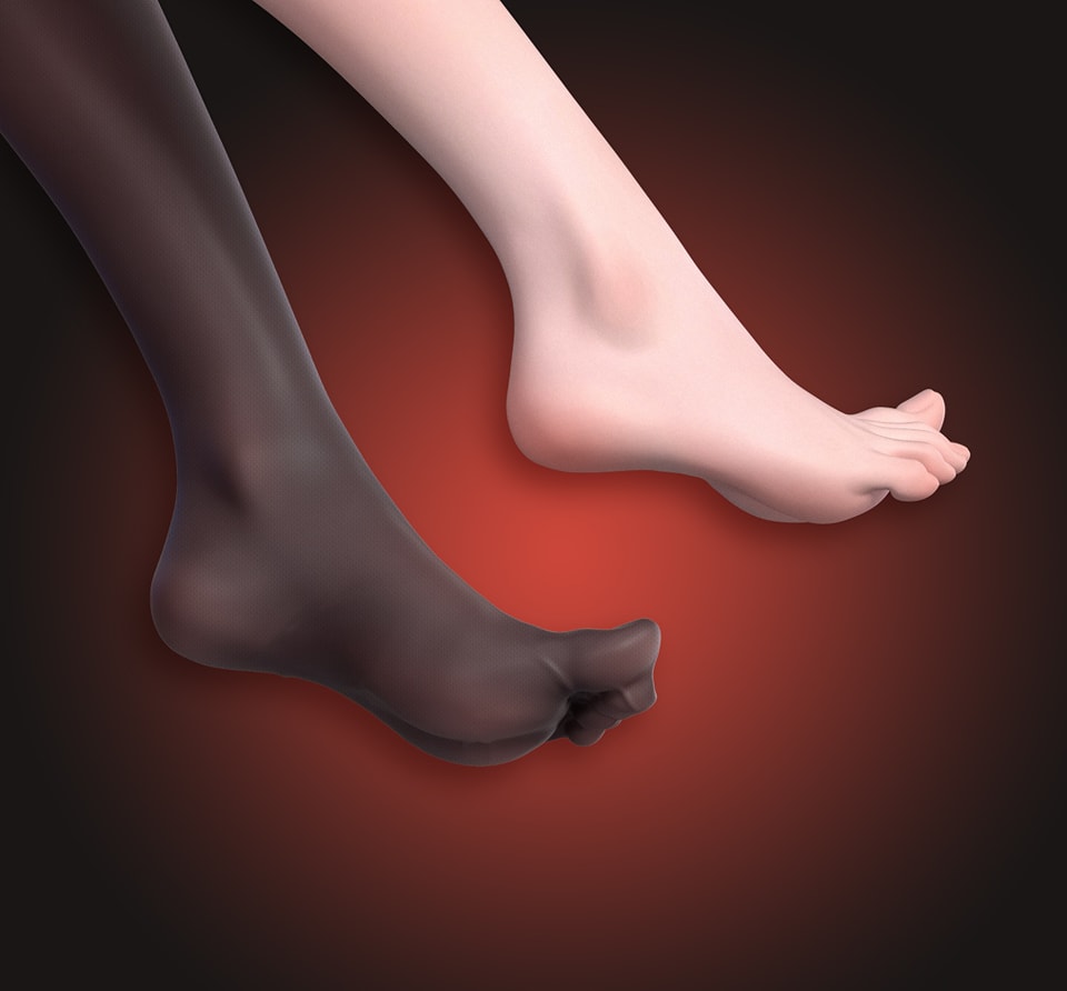 Amagi Throne Flower 1/4